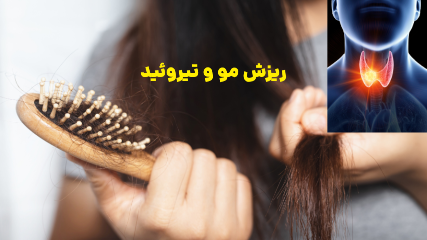 ریزش مو